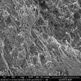 Carbon Nanotubes for high Strength Fibers